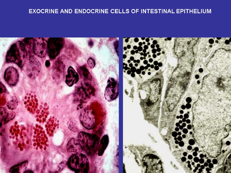 EXOCRINE AND ENDOCRINE CELLS OF INTESTINAL EPITHELIUM